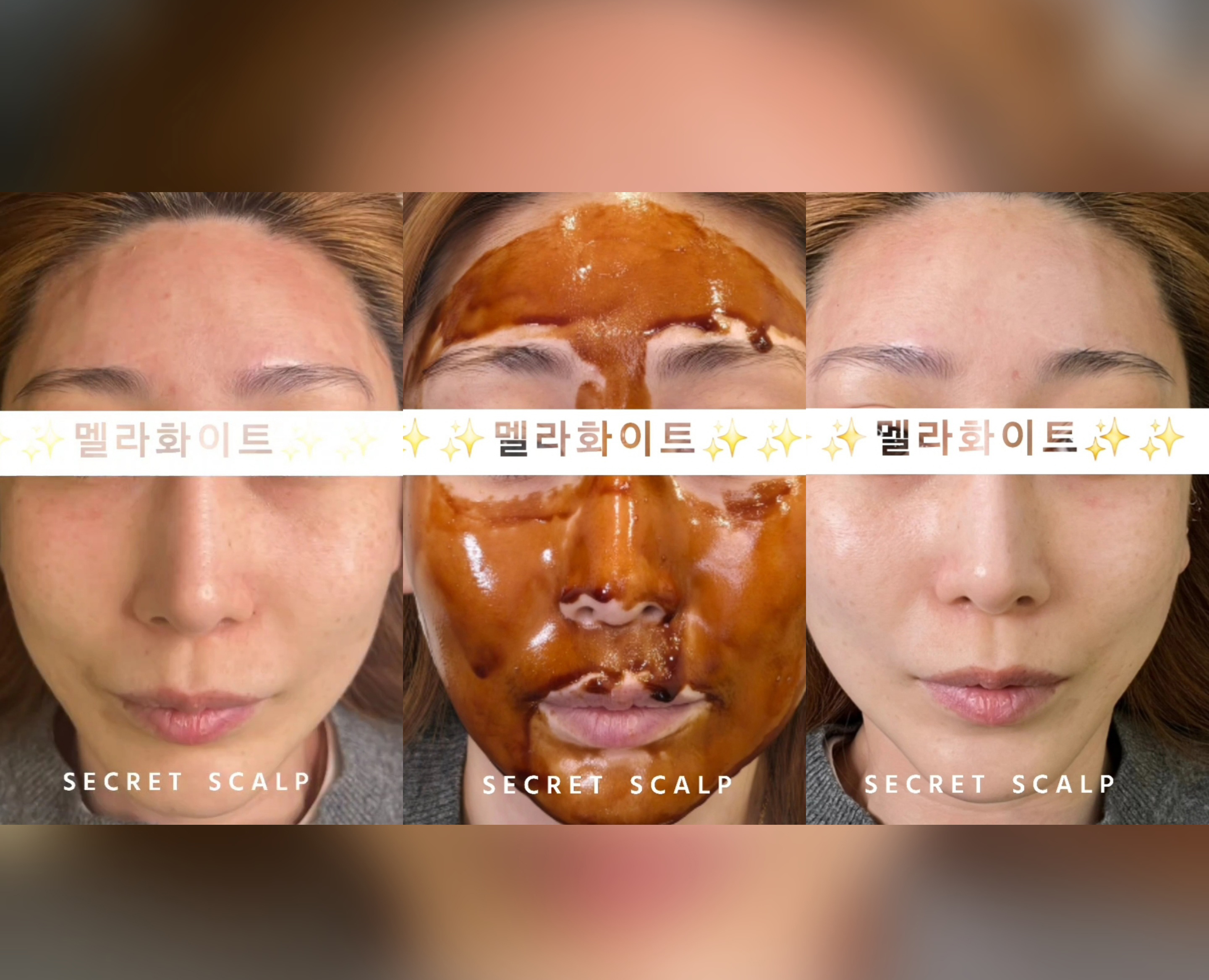 시크릿스칼프 대표 이미지