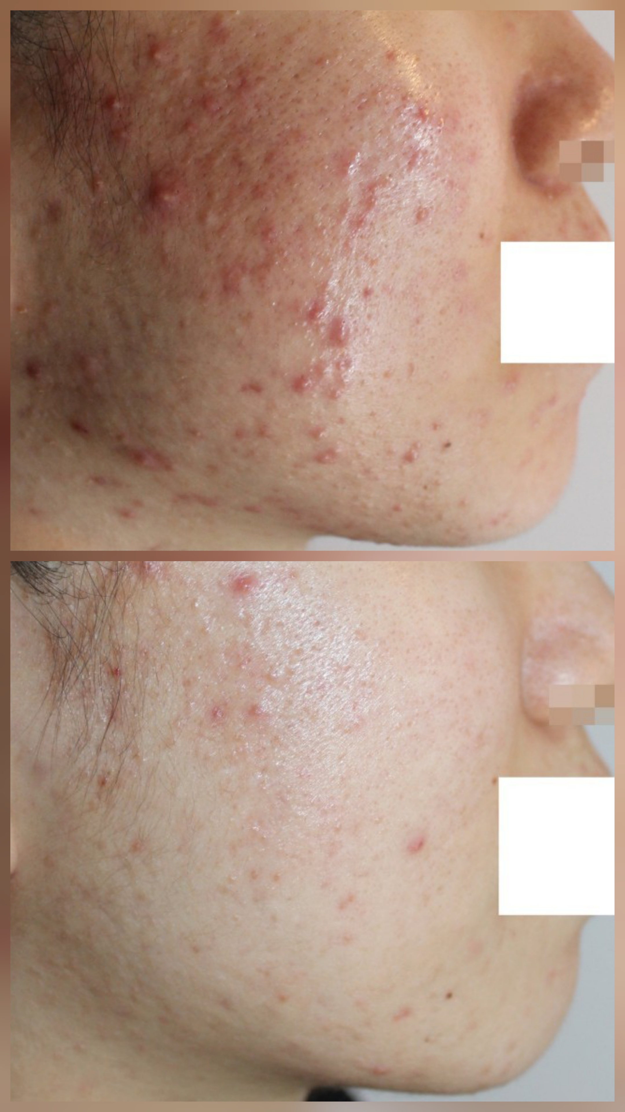 키썸에스테틱 병점본점 대표 이미지