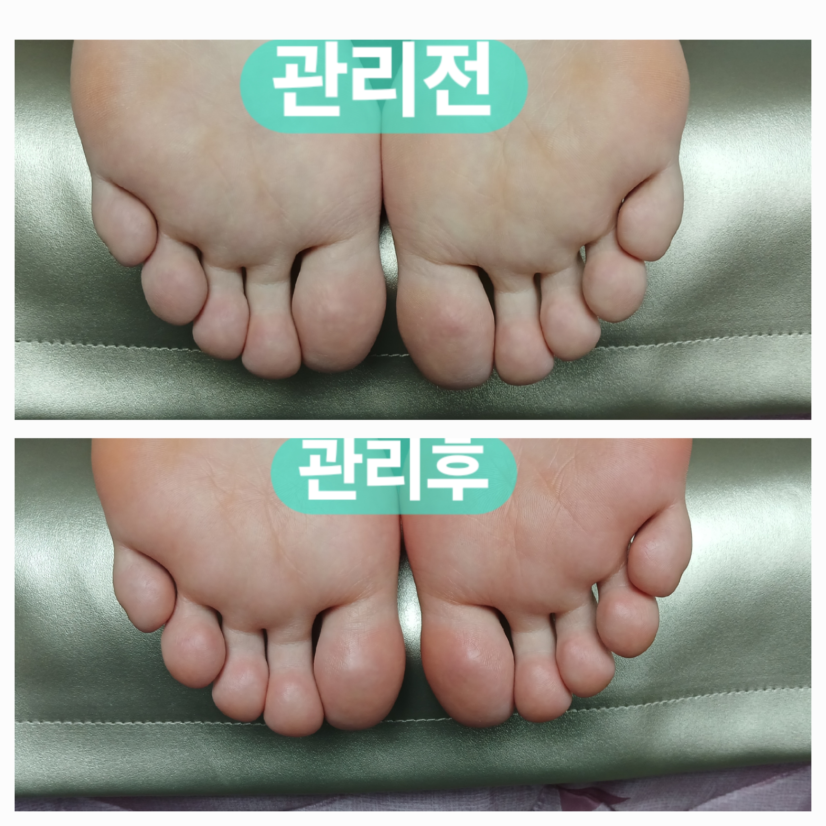 출장 벨라 대표 이미지