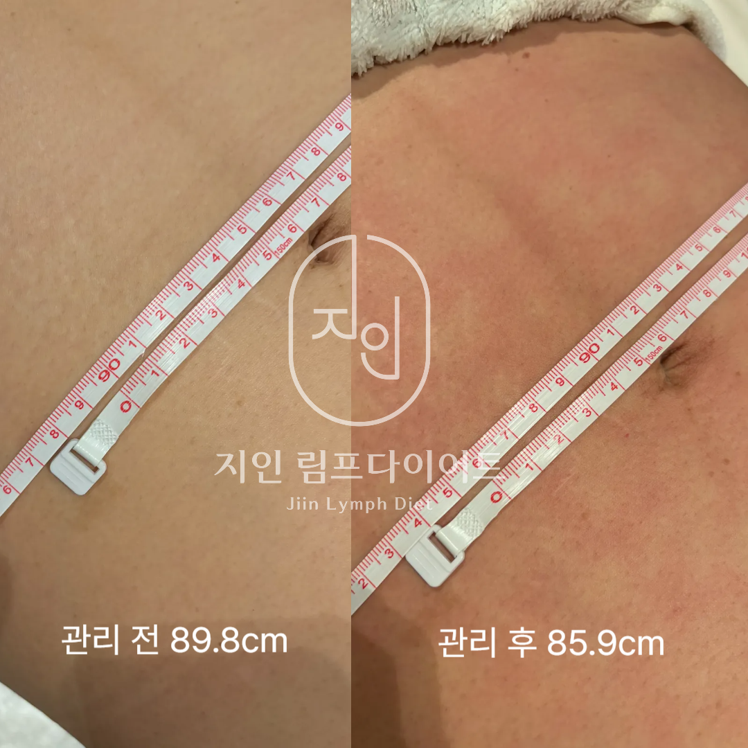 지인림프다이어트 photo 10