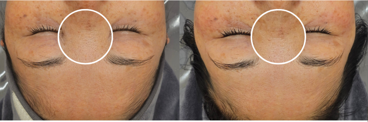 오로라뷰티 대표 이미지