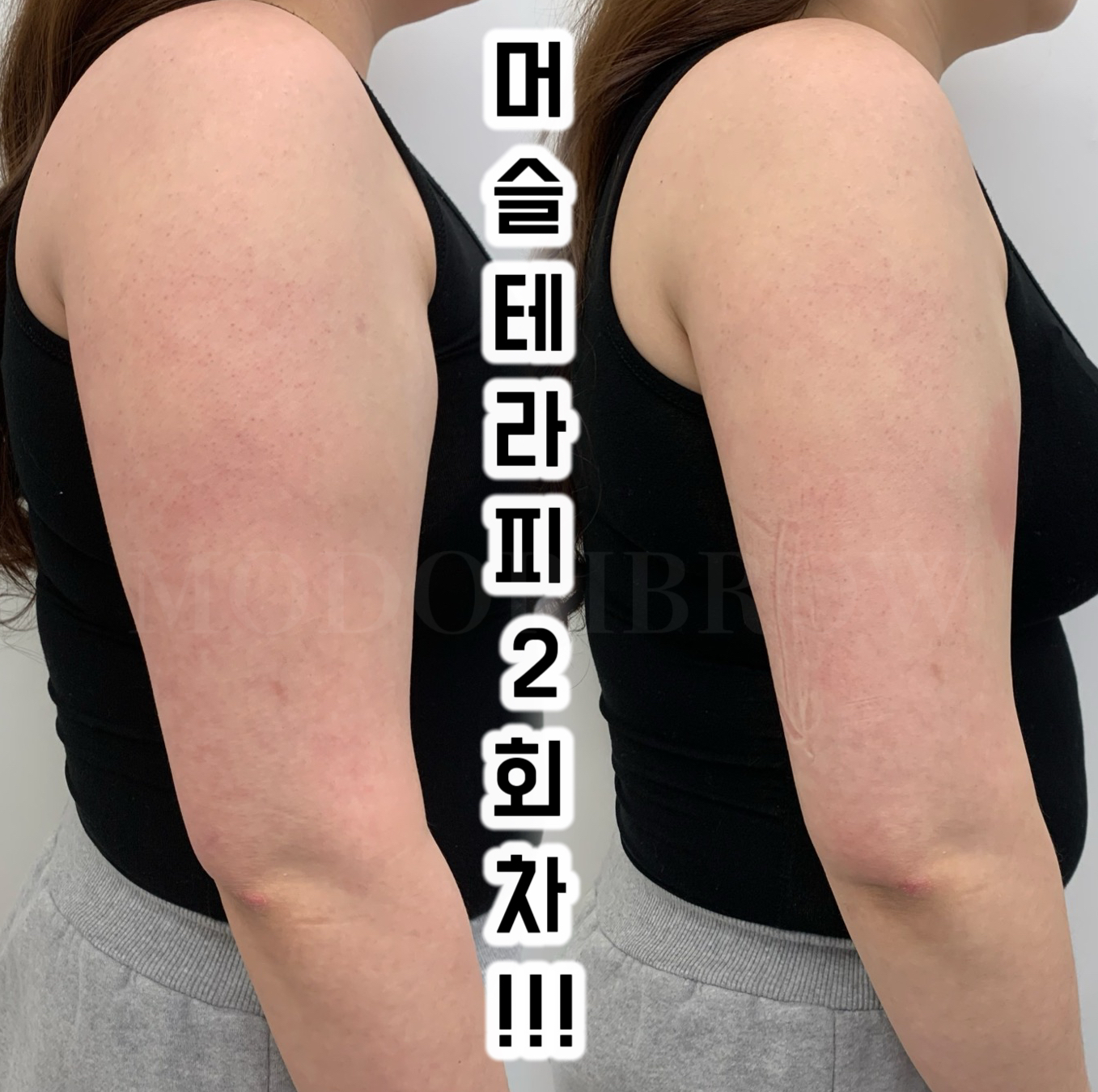 모도리브로우 이미지