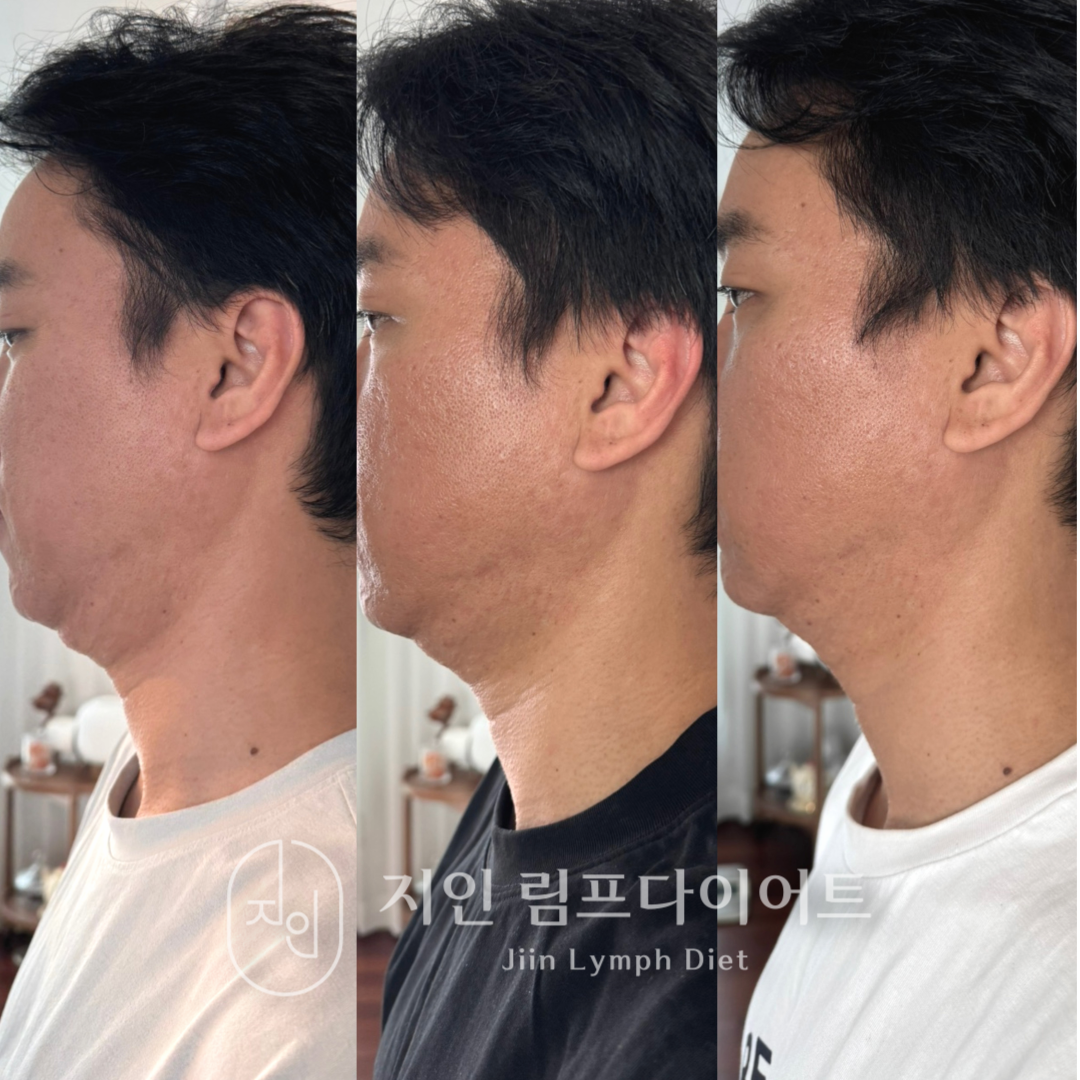 지인림프다이어트 photo 8