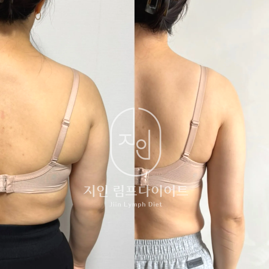 지인림프다이어트 photo 5