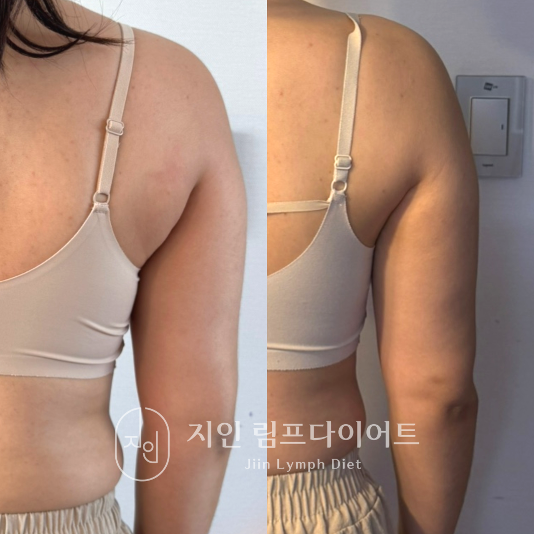 지인림프다이어트 photo 7