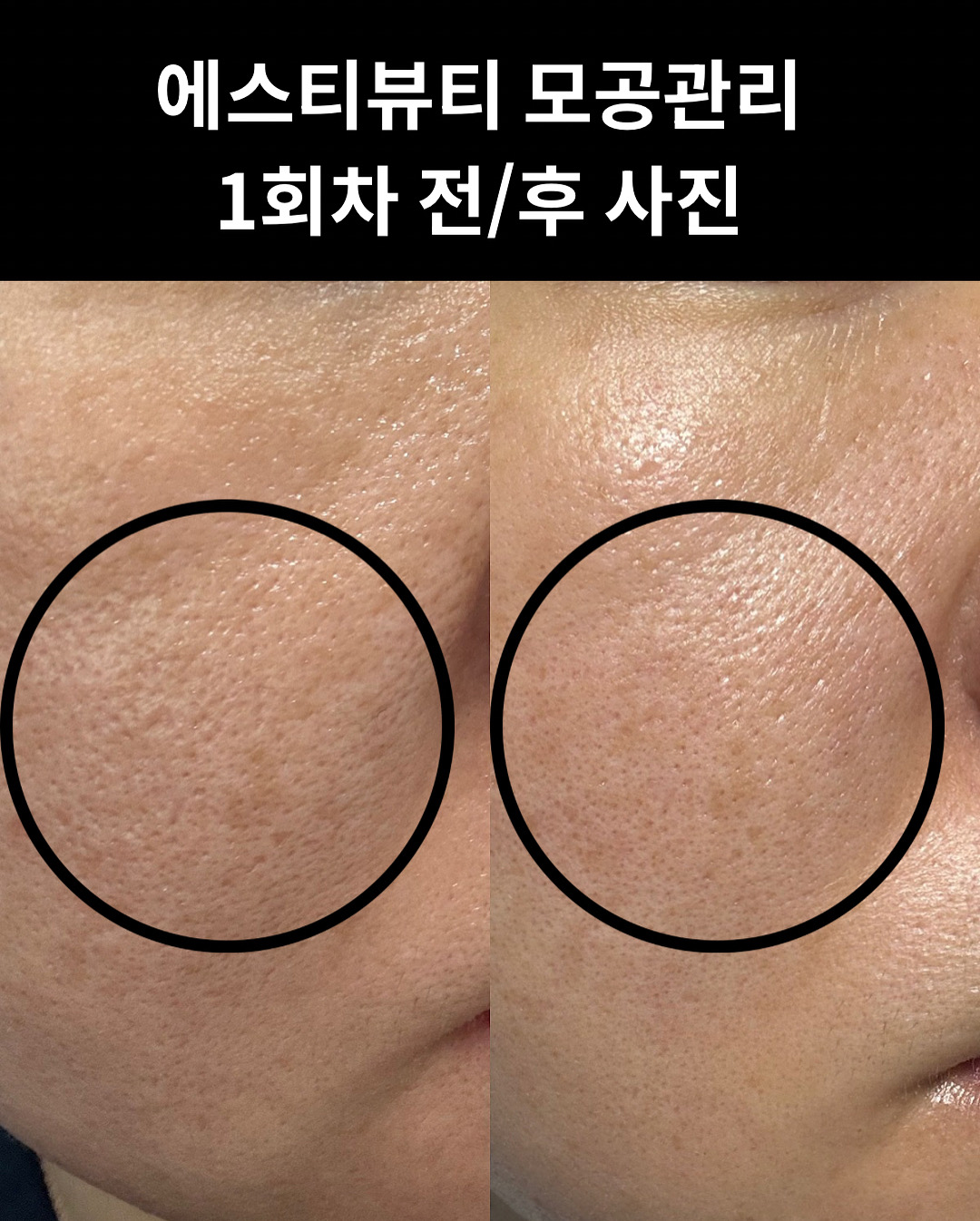에스티뷰티 photo 8