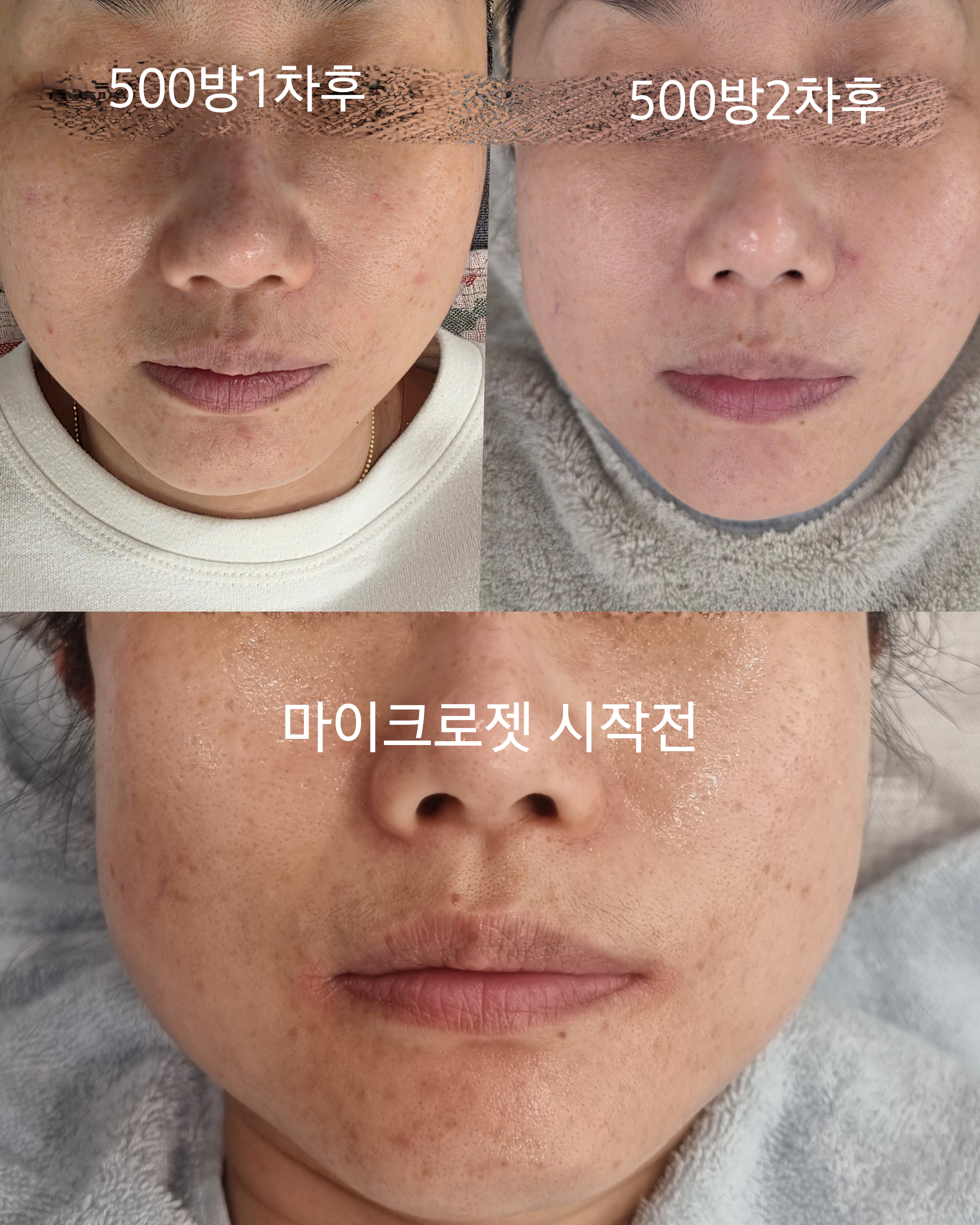 린다아이래쉬 photo 7