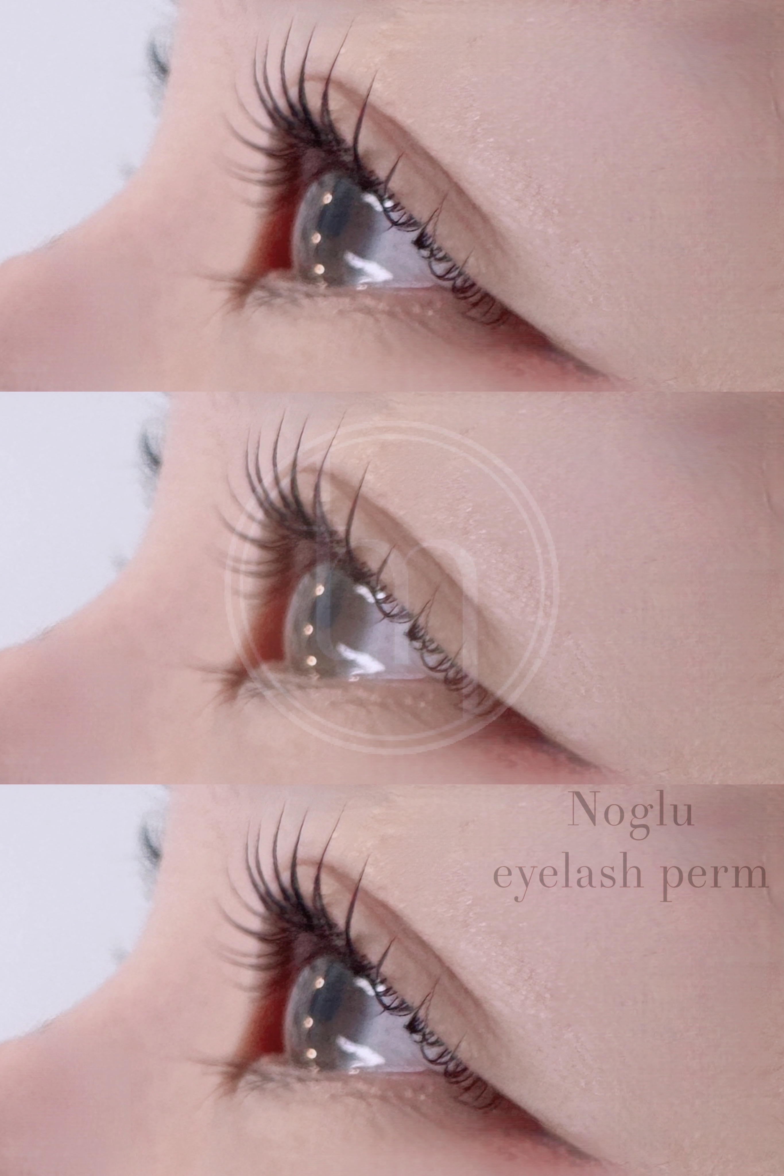 더모어 대표 이미지