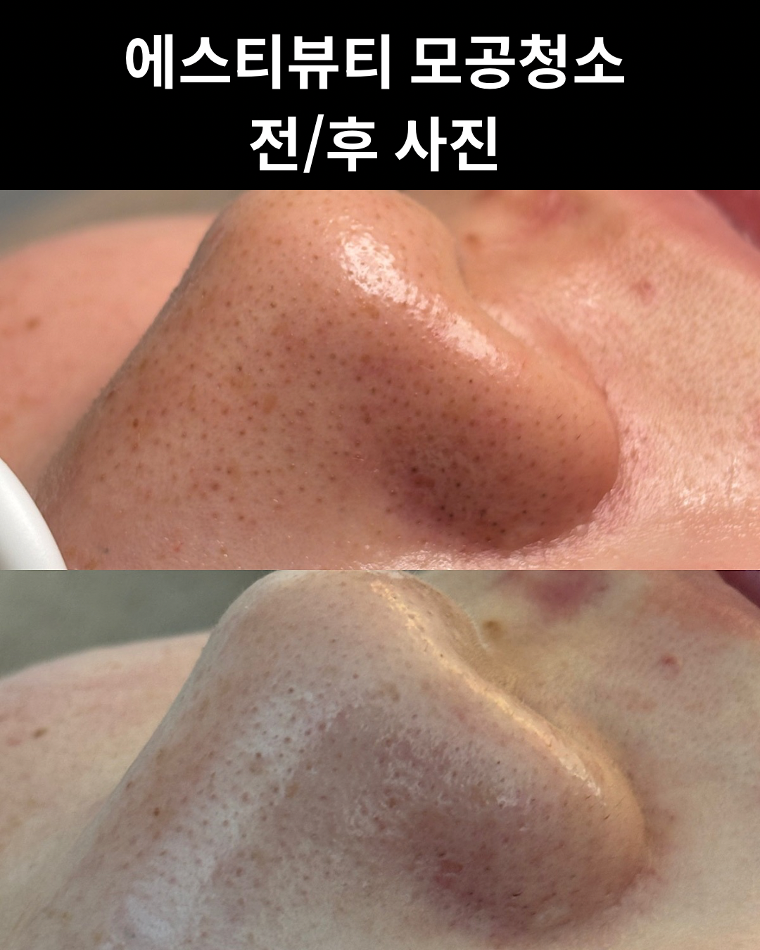 에스티뷰티 photo 6