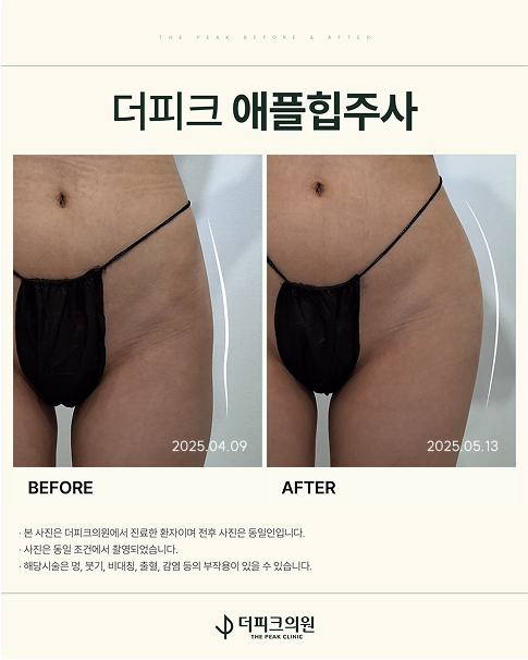 더피크