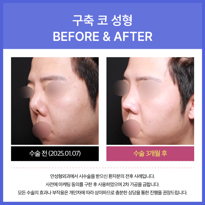 안성형외과의원 대표 이미지