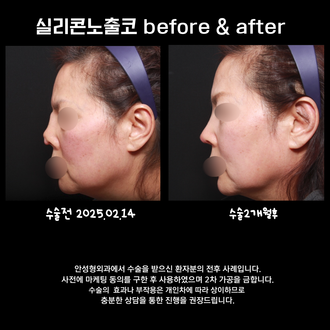 안성형외과 대표 이미지