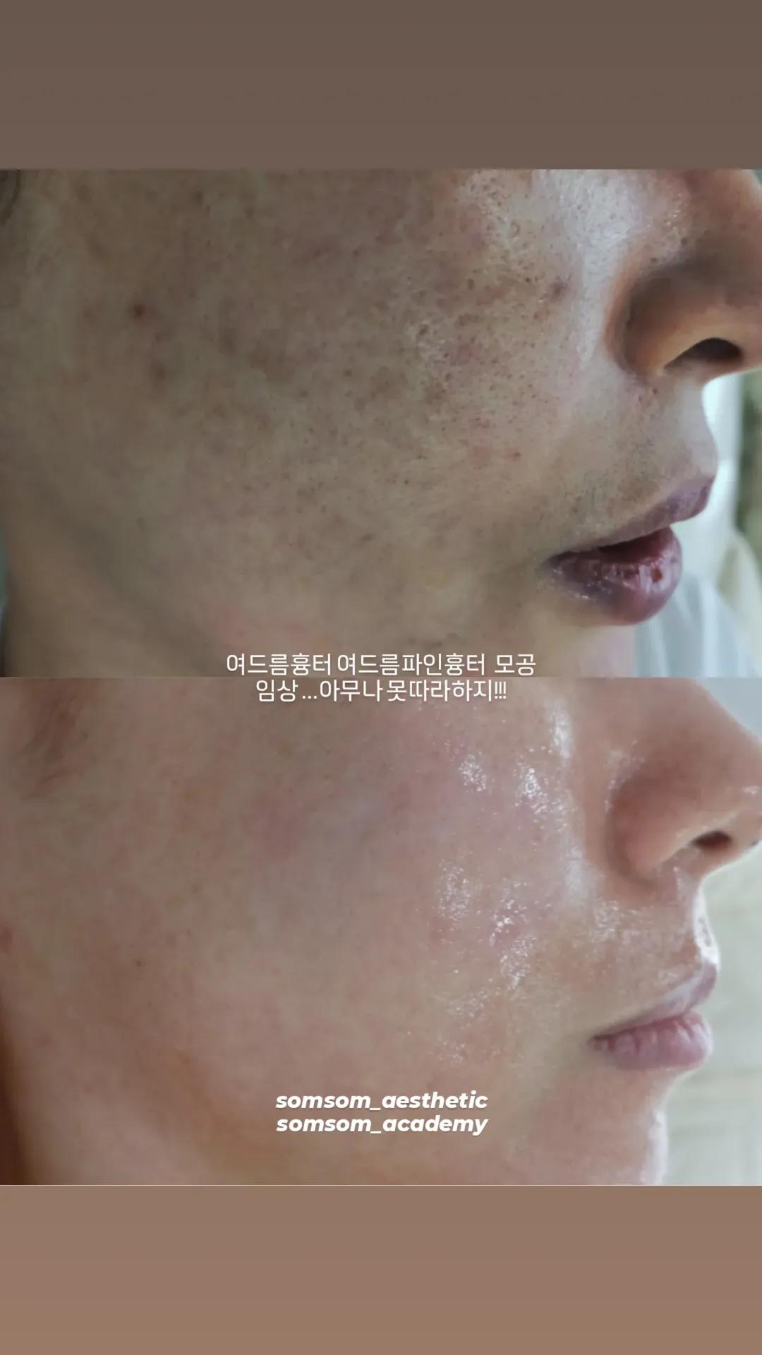 솜솜에스테틱 강남 선릉본점 대표 이미지