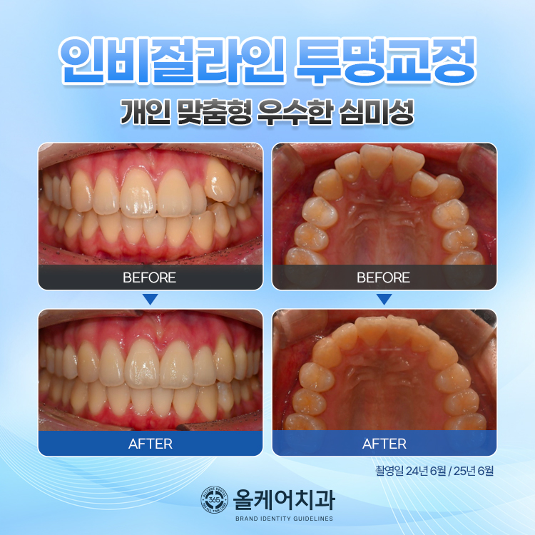 365올케어치과의원 대표 이미지