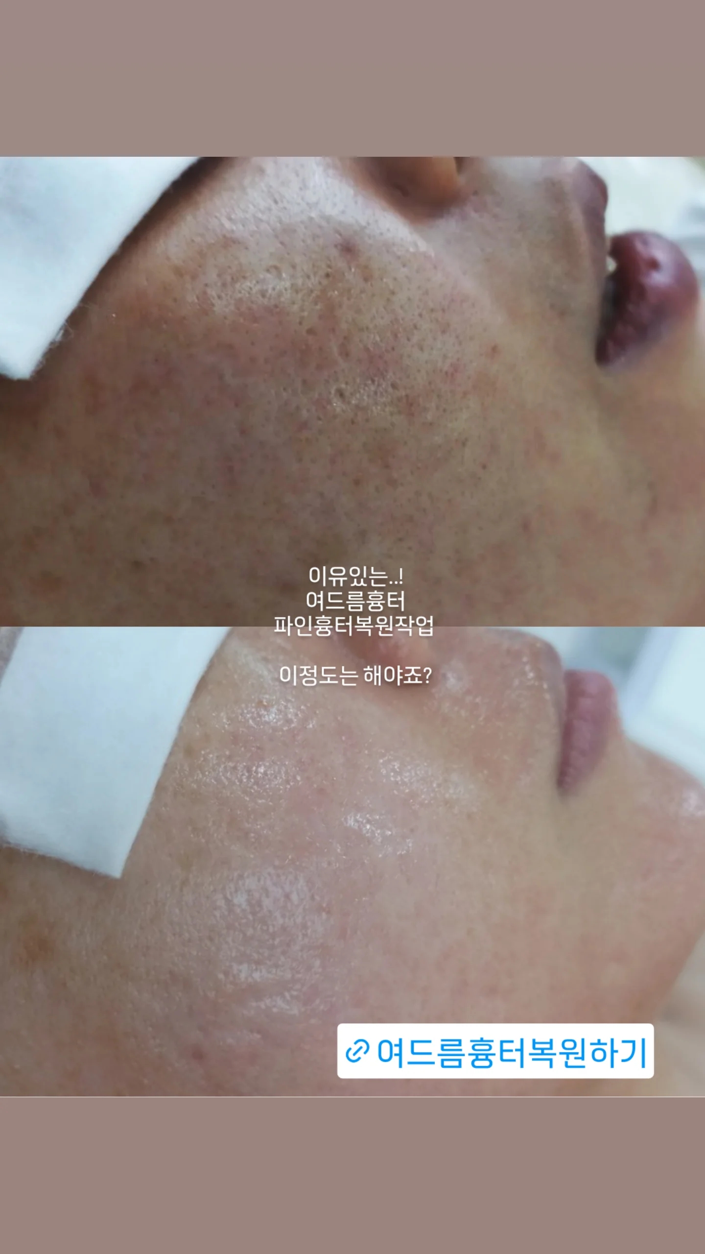 솜솜에스테틱 강남 선릉본점 대표 이미지