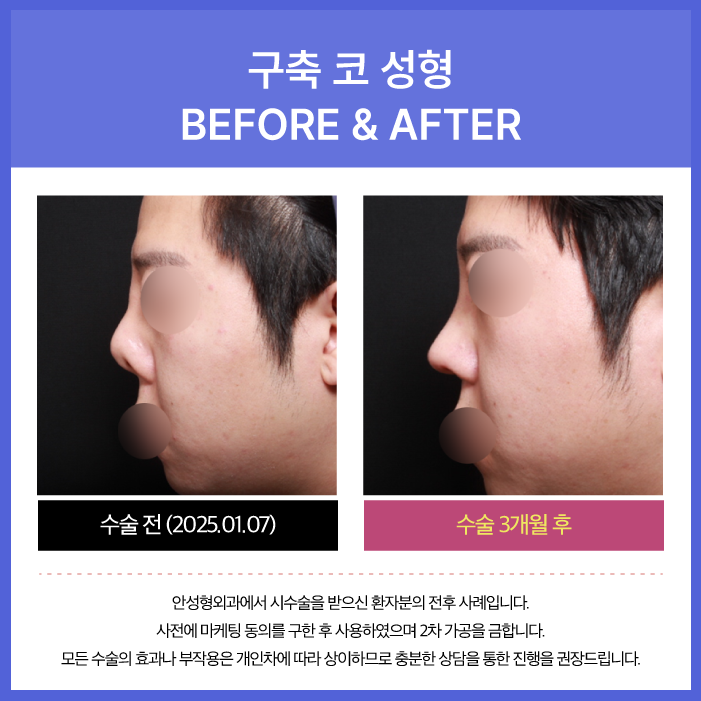 안성형외과 이미지