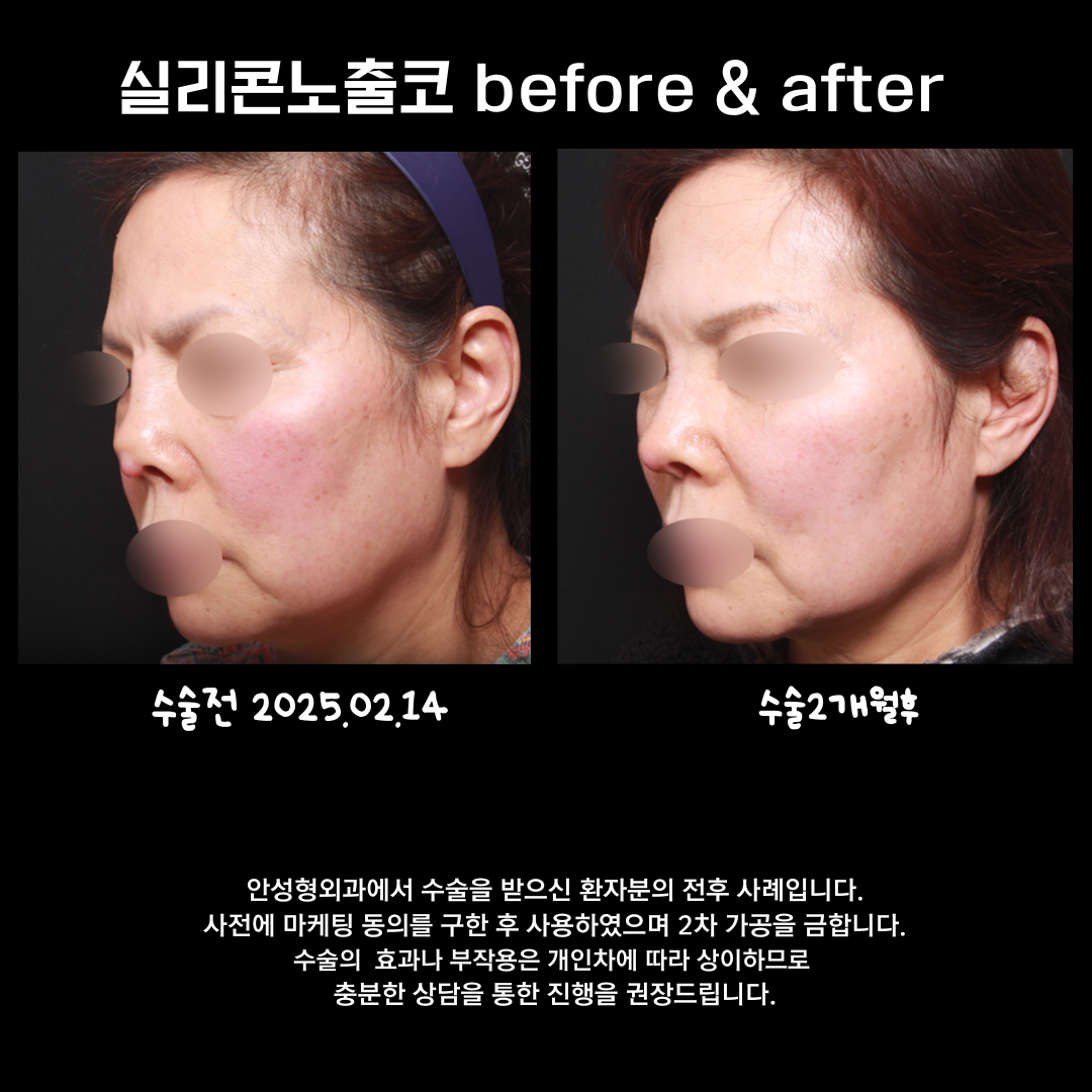 안성형외과의원 대표 이미지