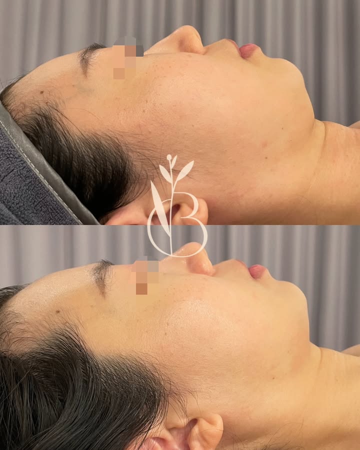 뷰티온리 의정부본점 대표 이미지