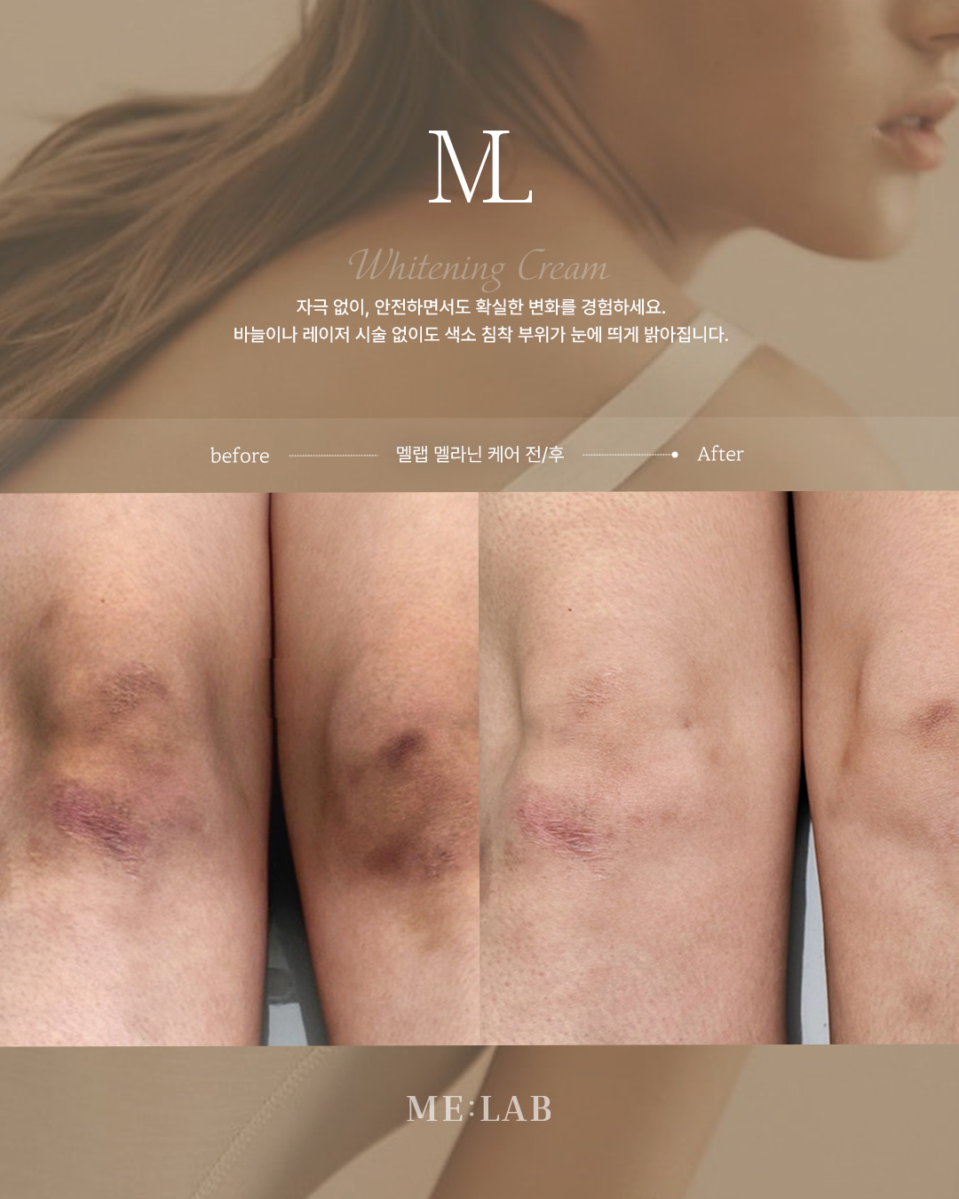 투미슈가링왁싱 왕십리점 대표 이미지
