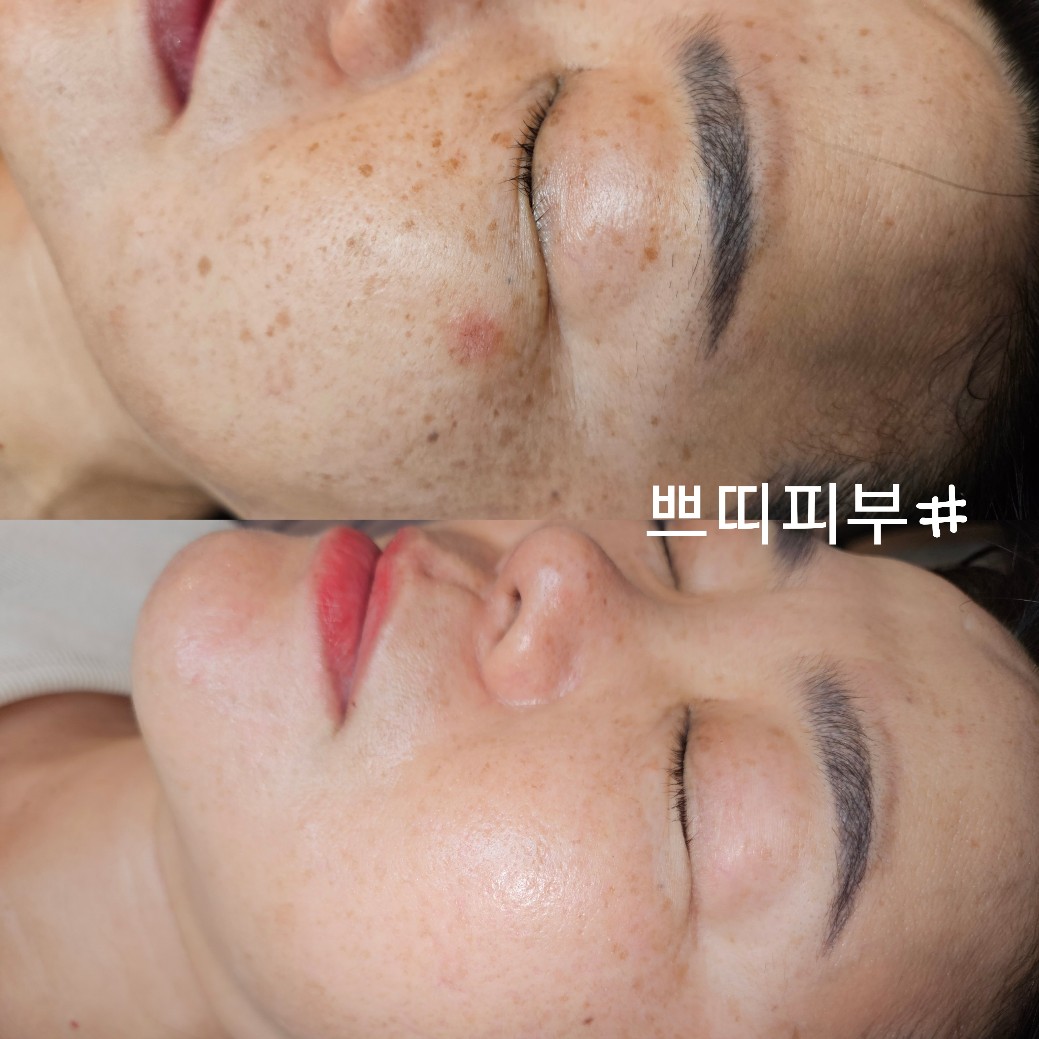 쁘띠피부샵 대표 이미지