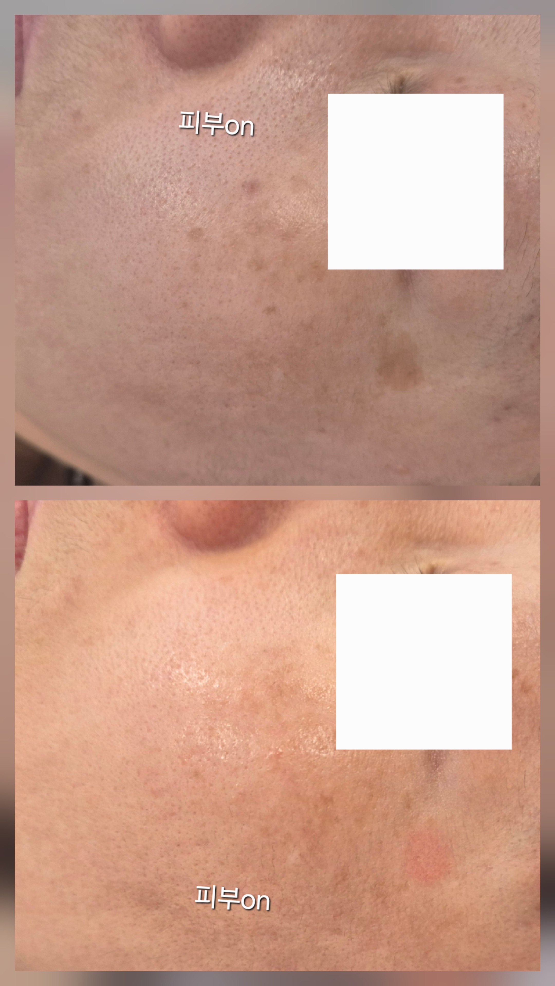 피부ON 대표 이미지