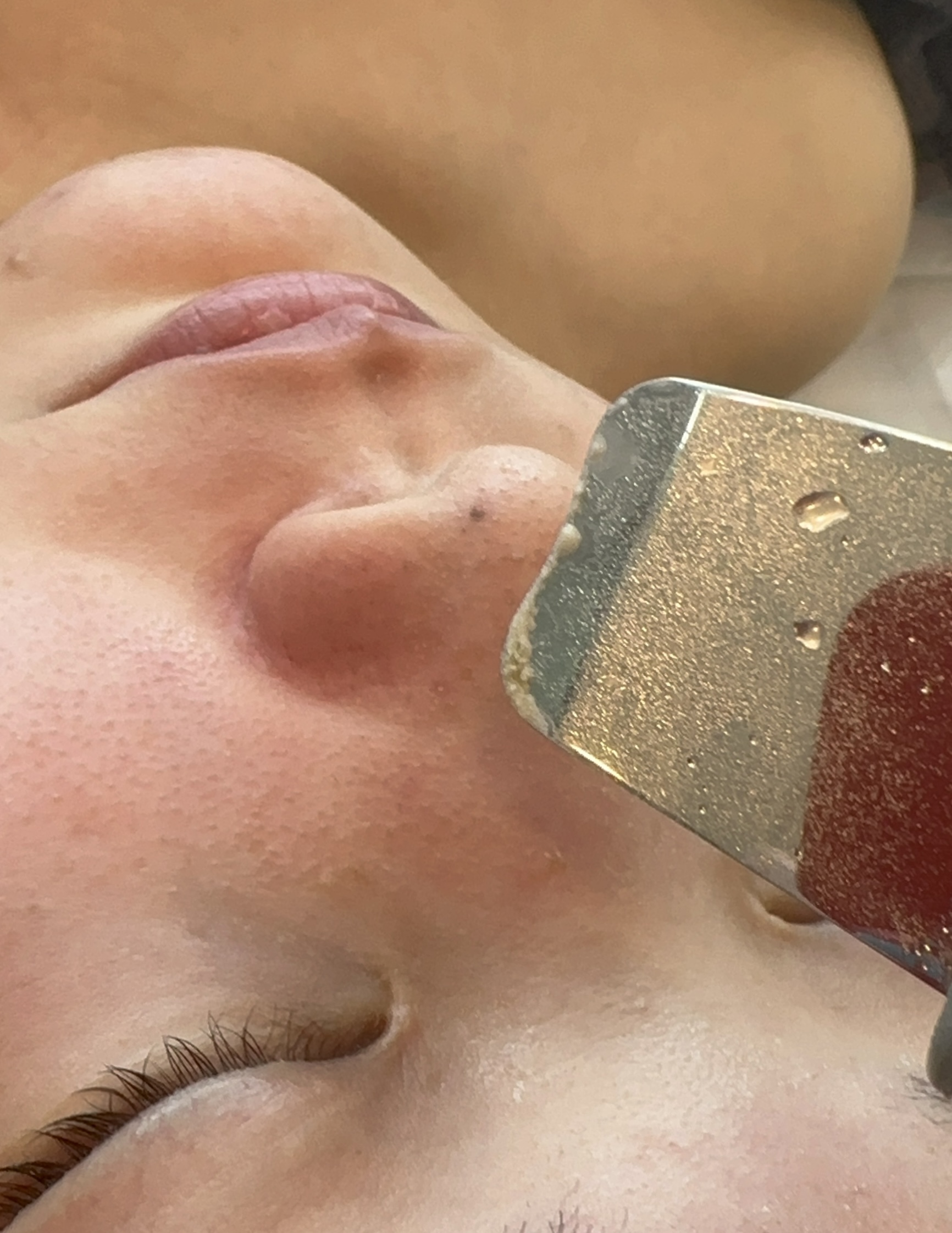 샤인온에스테틱 파주운정점 대표 이미지