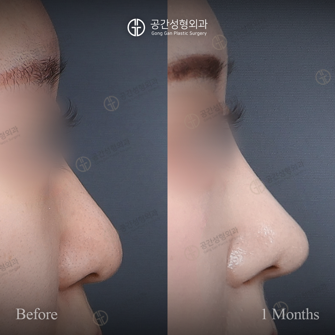 공간성형외과의원 대표 이미지