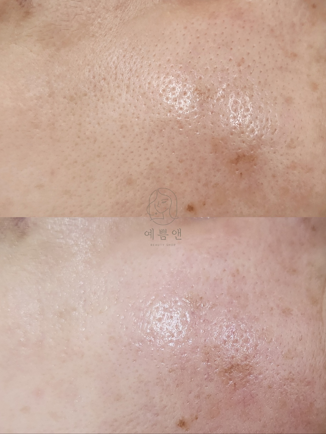 예쁨앤 대표 이미지