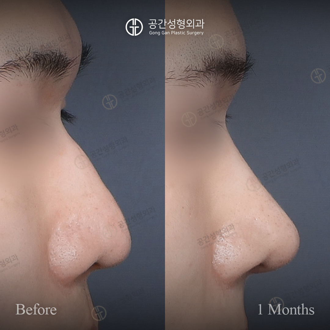 공간성형외과의원 대표 이미지