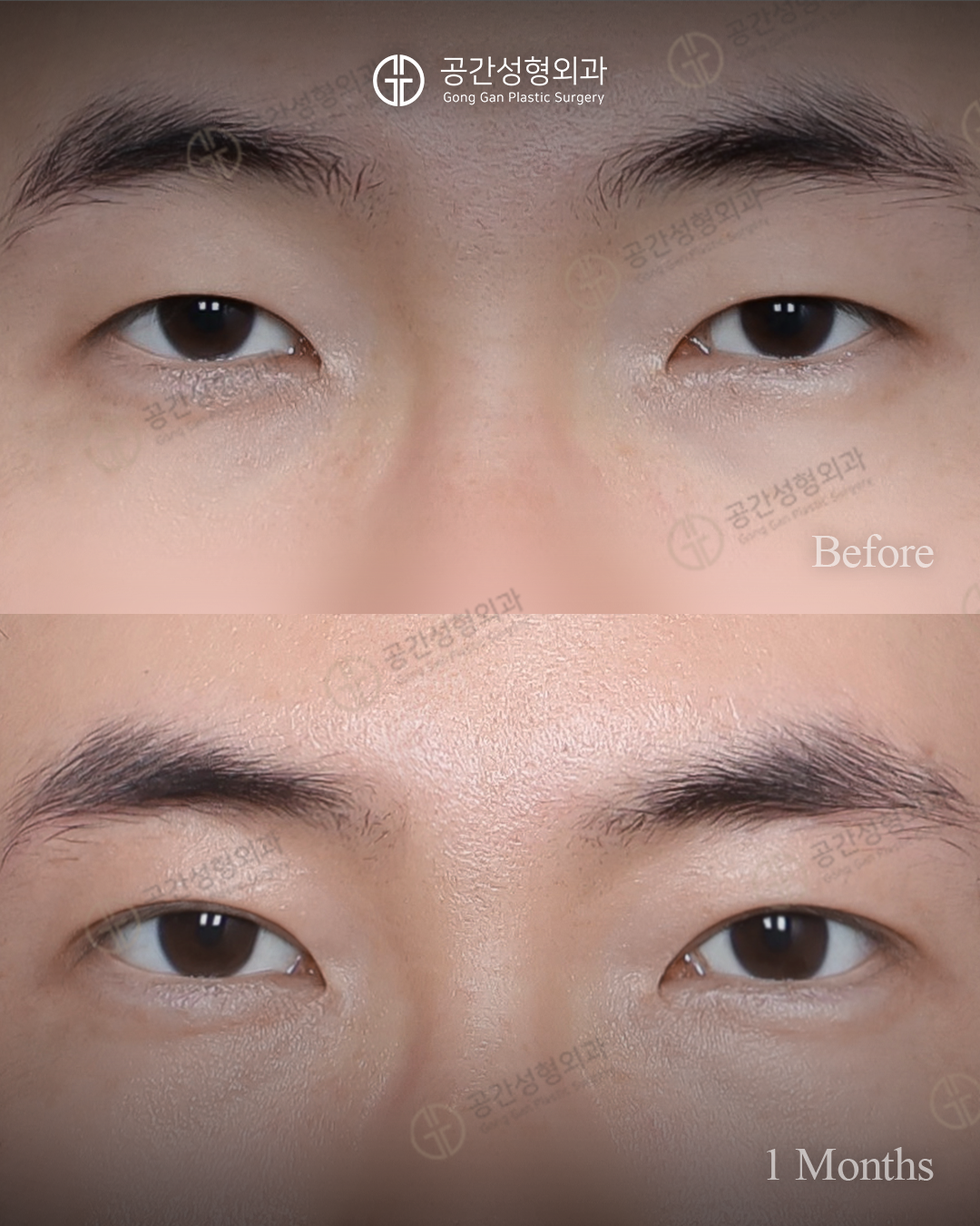 공간성형외과의원 대표 이미지