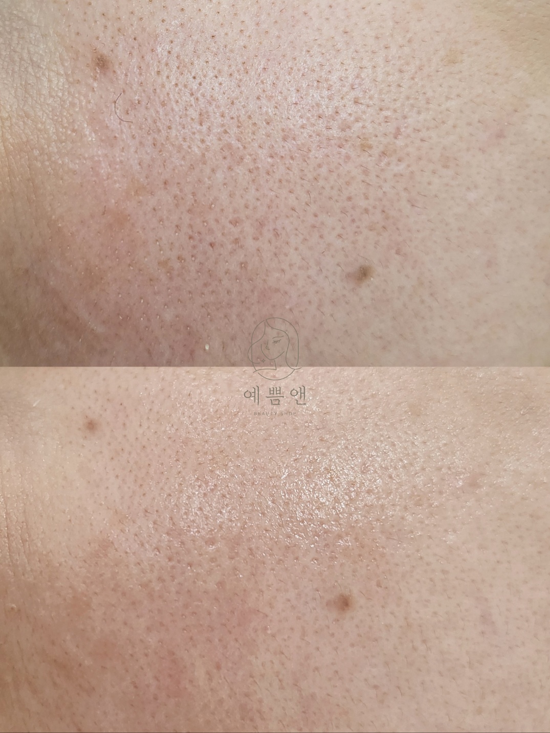 예쁨앤 대표 이미지