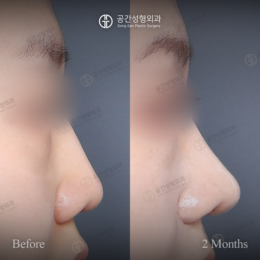 공간성형외과의원 대표 이미지