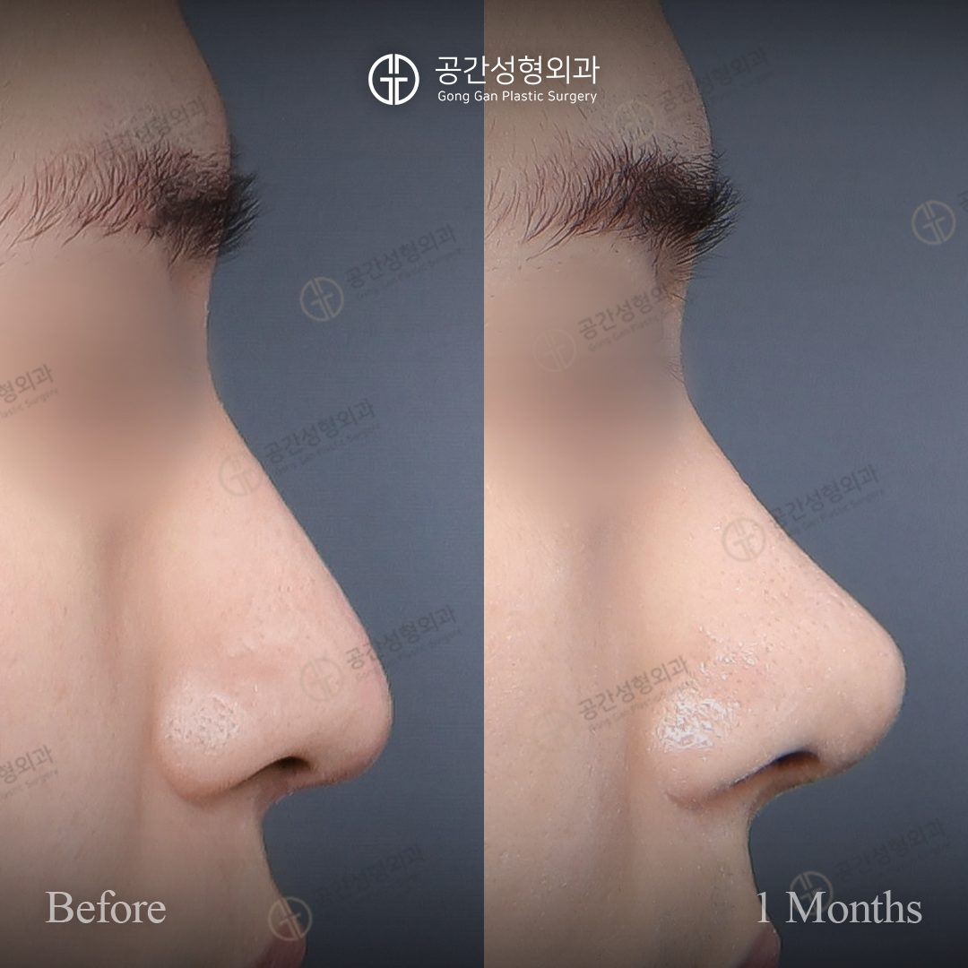 공간성형외과의원 대표 이미지