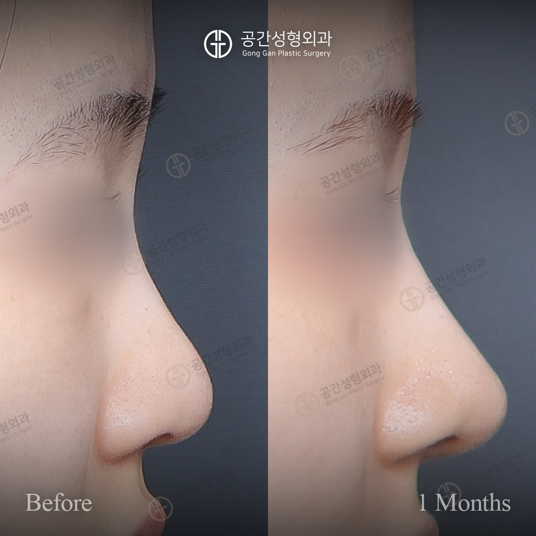 공간성형외과의원 대표 이미지