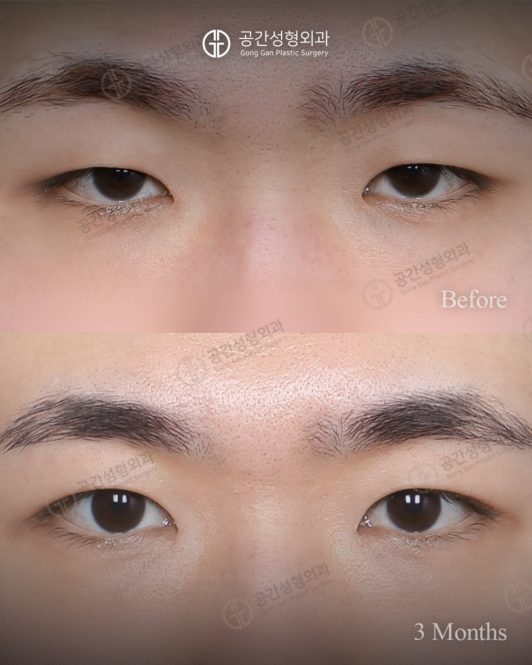 공간성형외과의원 대표 이미지