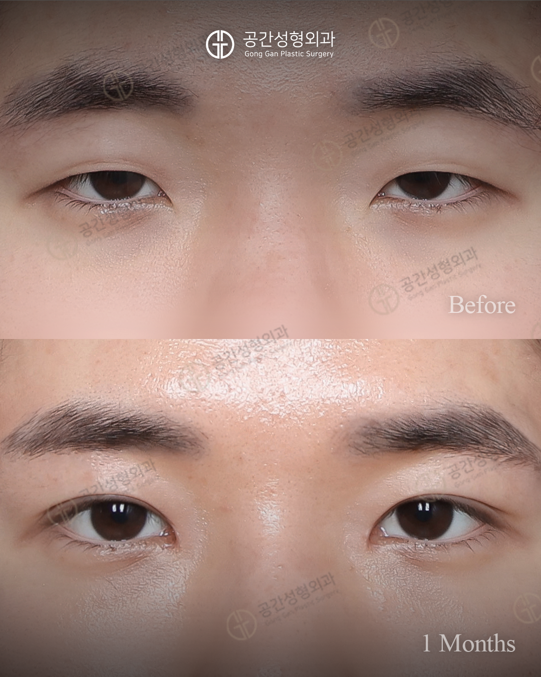 공간성형외과의원 대표 이미지