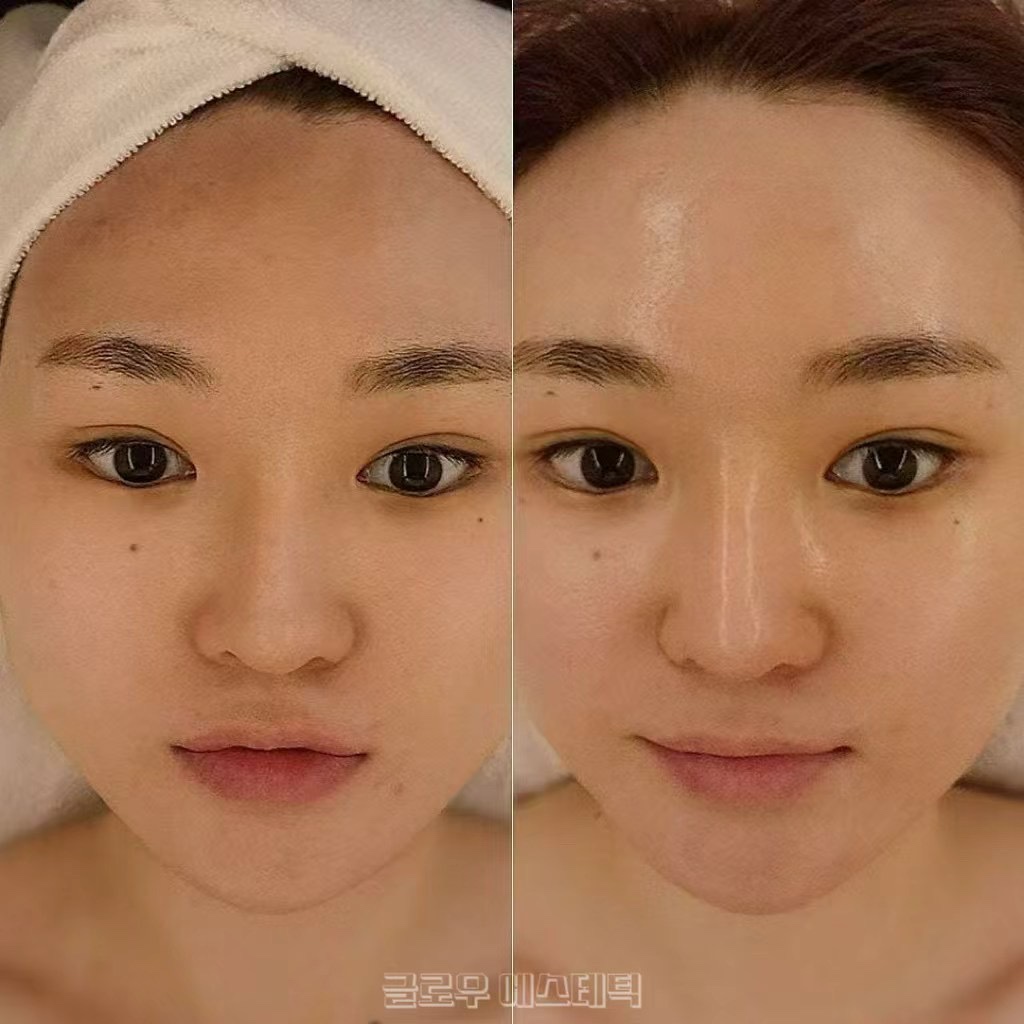 글로우 에스테틱 대표 이미지