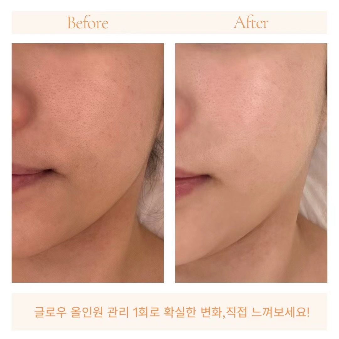 글로우 에스테틱 대표 이미지