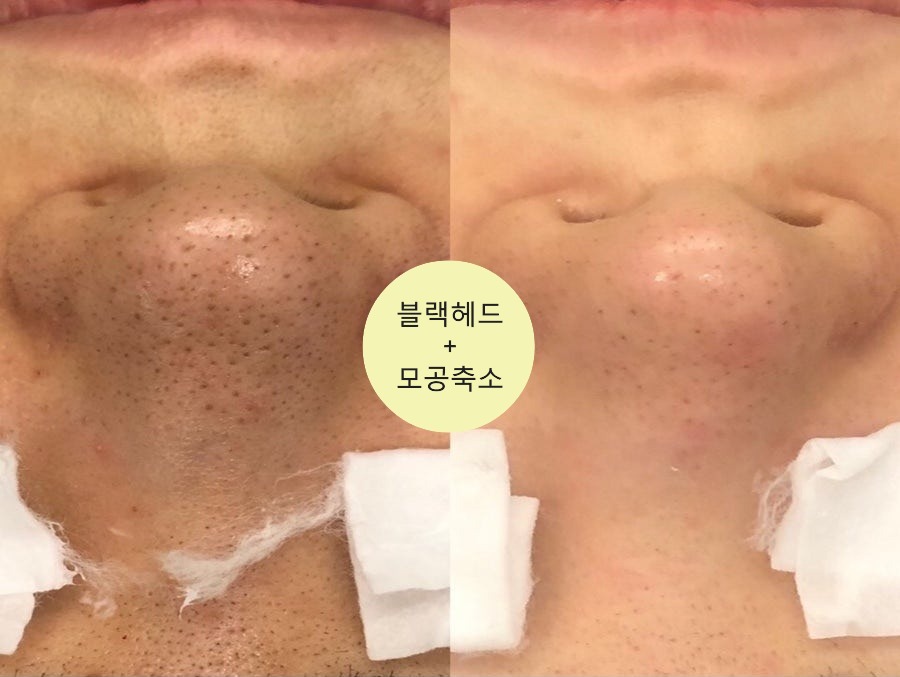 키썸에스테틱 병점본점 대표 이미지