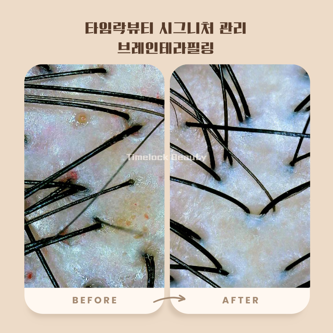 타임락뷰티 photo 2