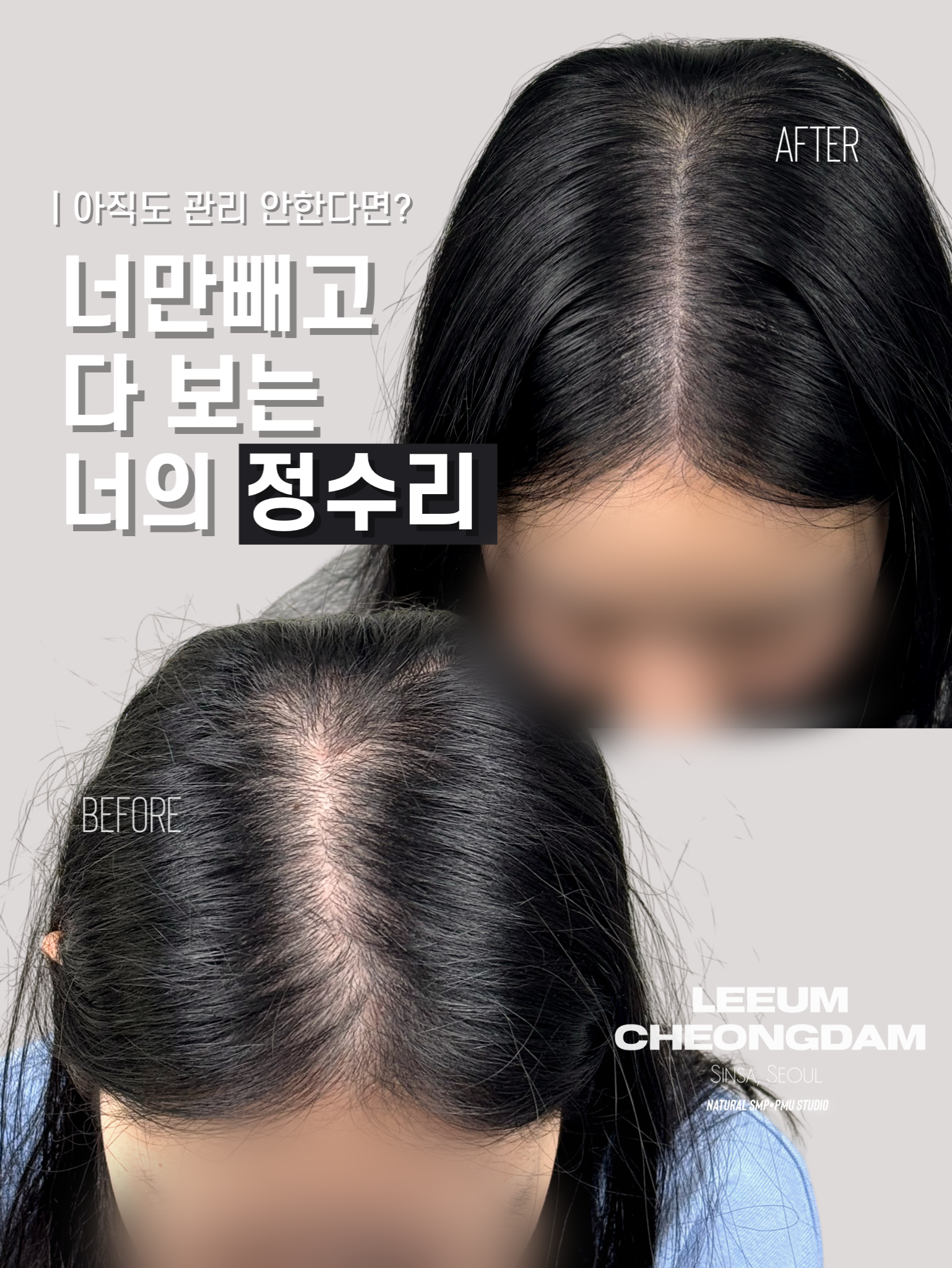 더리움 대표 이미지