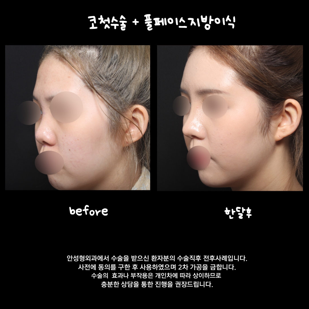 안성형외과 대표 이미지