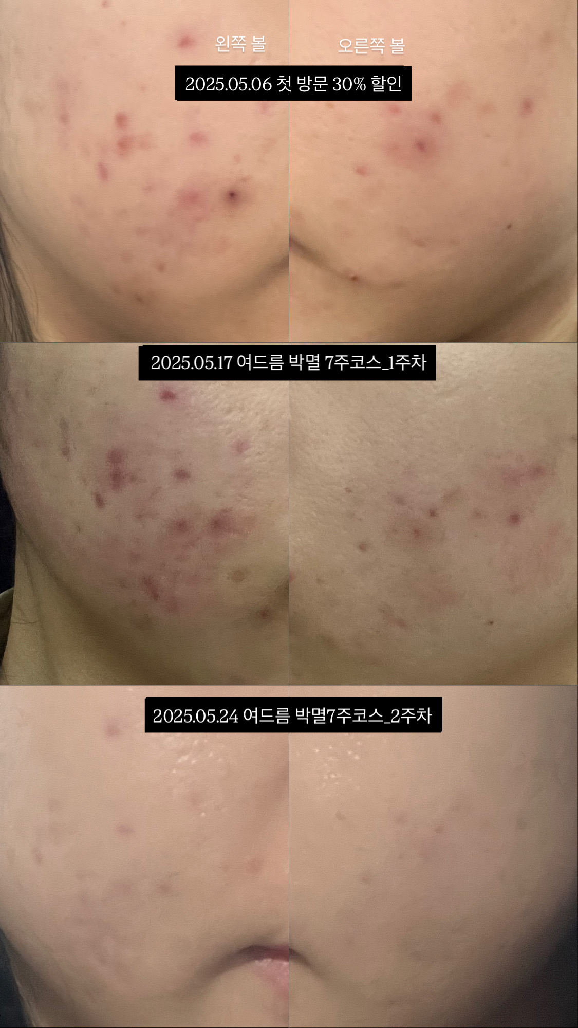 플로럴스킨 대표 이미지