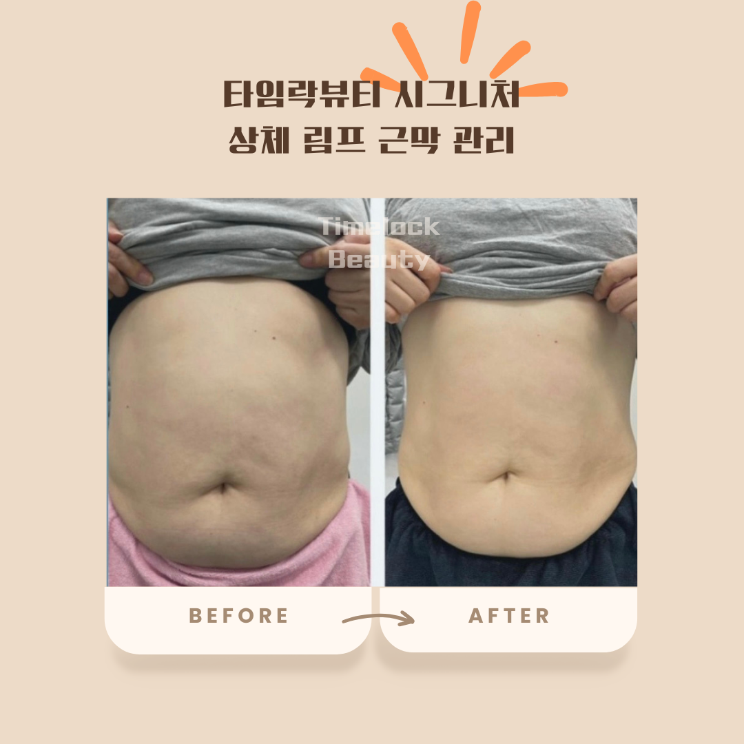 타임락뷰티 photo 5