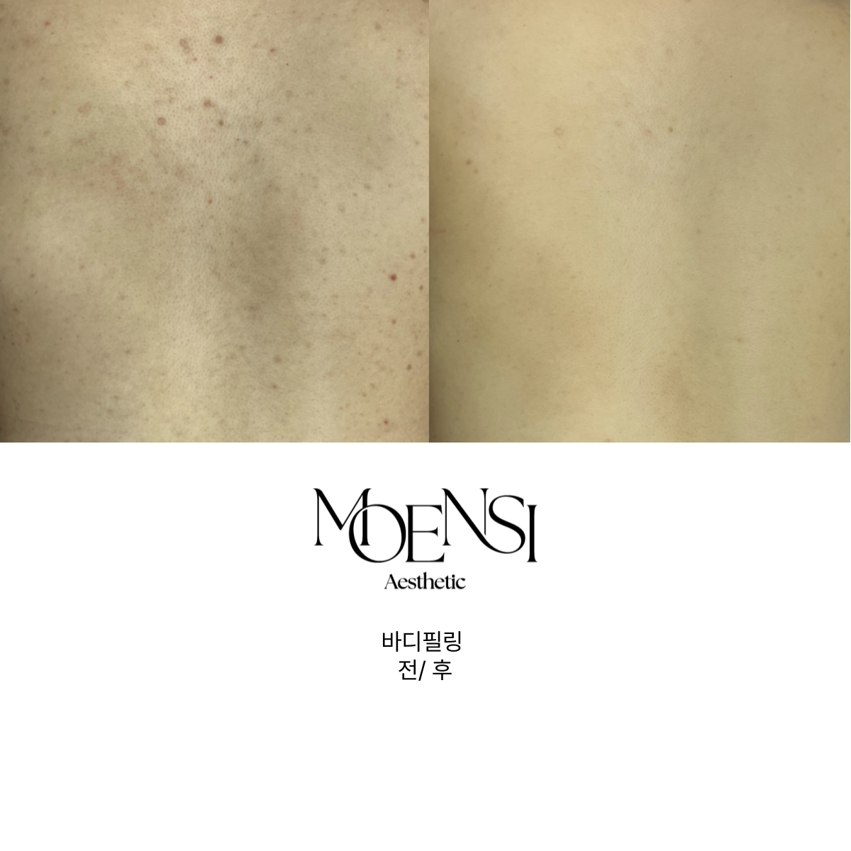 모앤시 대표 이미지