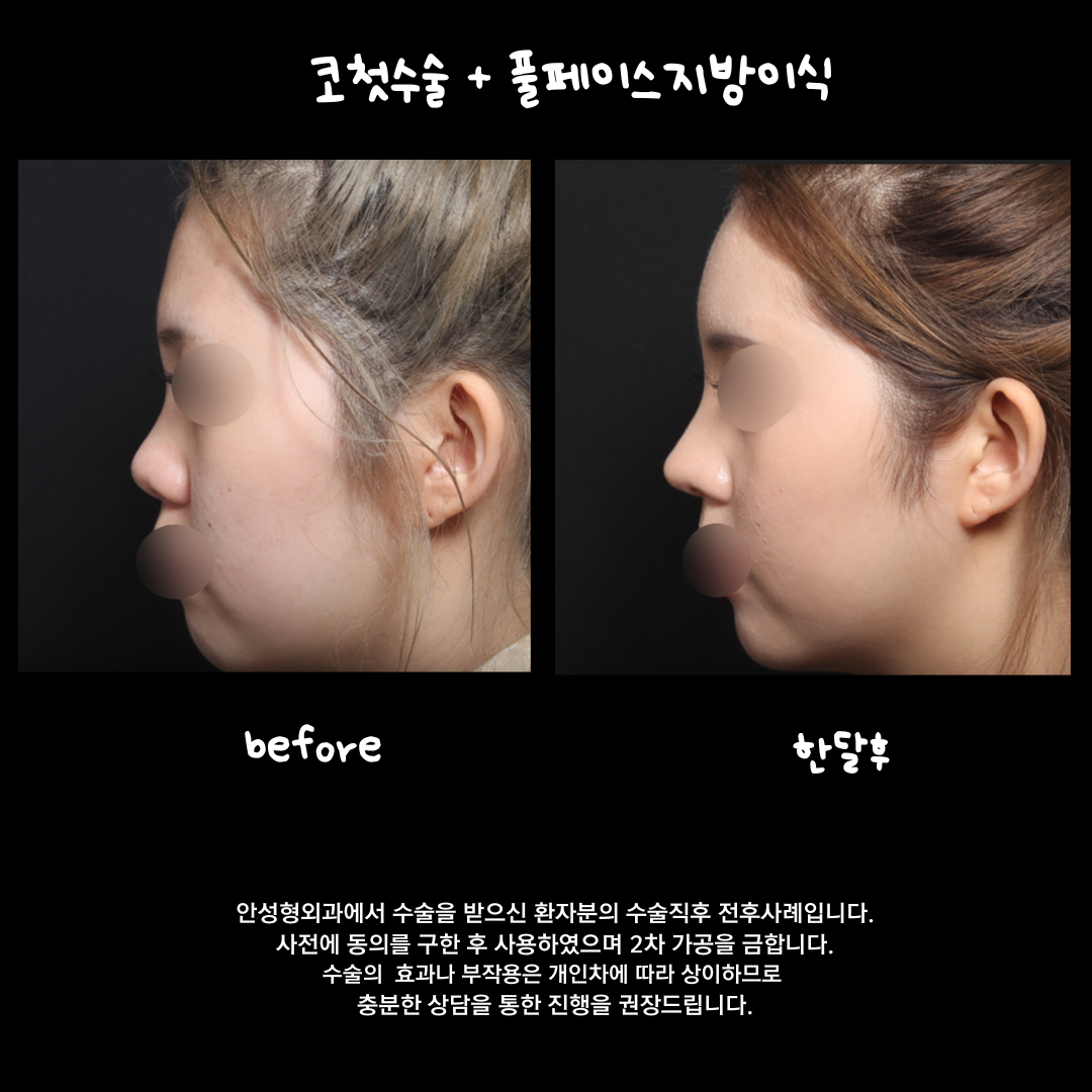 안성형외과 대표 이미지