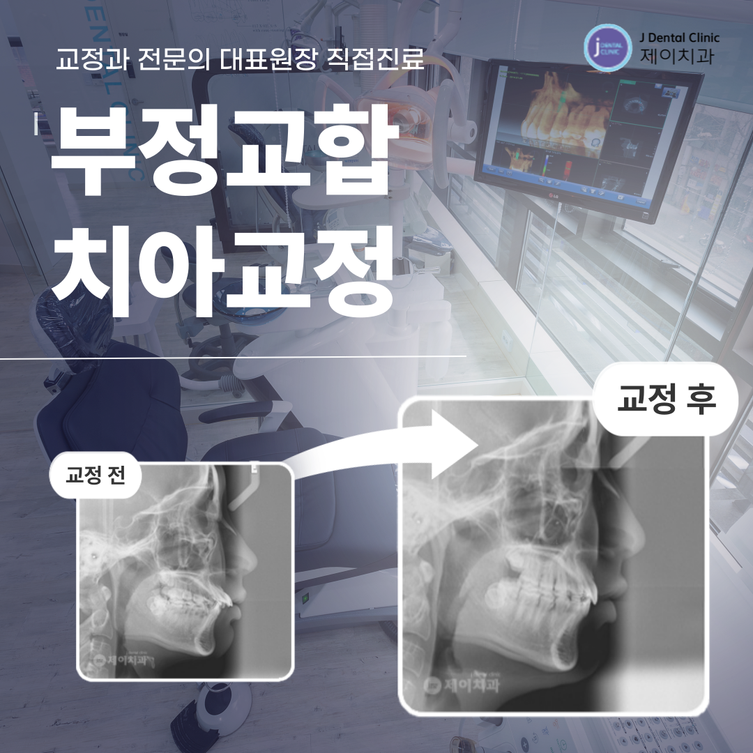 제이치과의원 대표 이미지