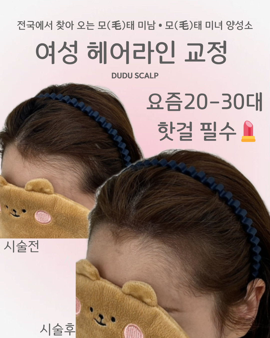 두두스칼프SMP 대구본점 대표 이미지
