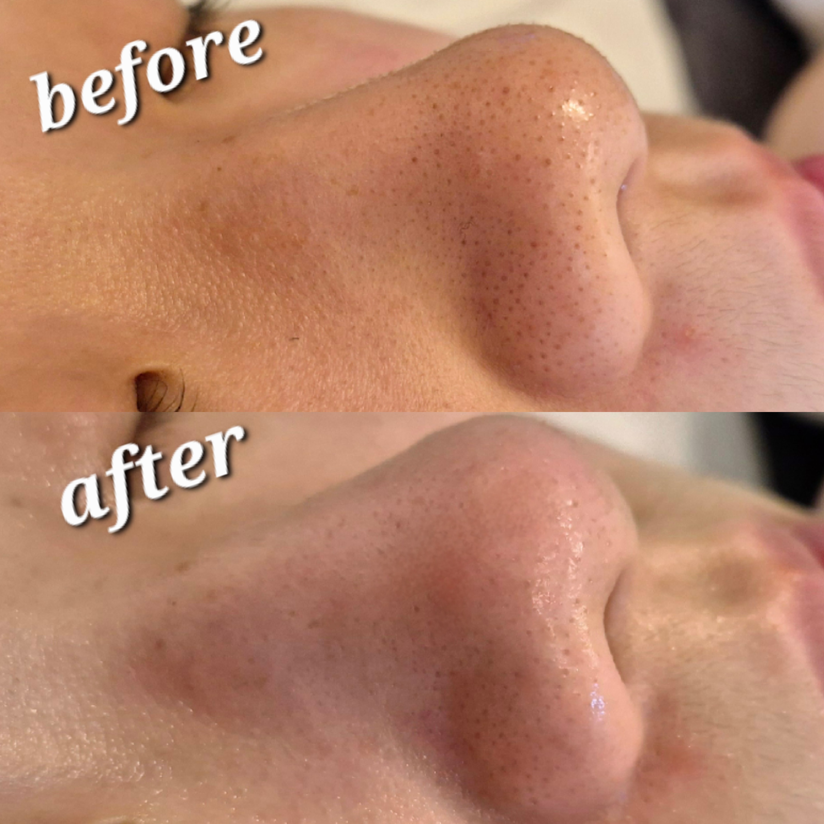 고원장의모공세척테라피 분당점 대표 이미지