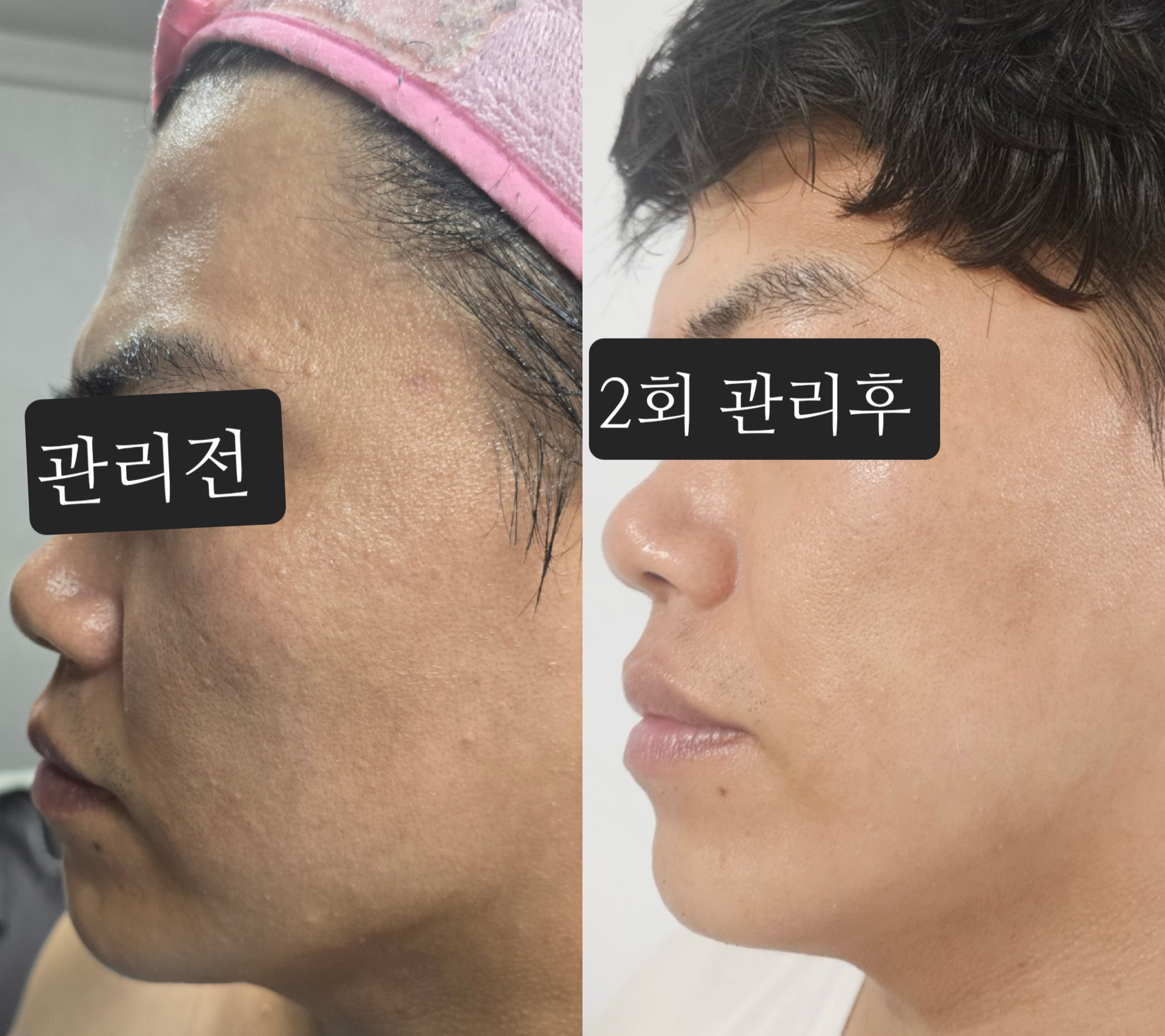 뷰티스킨케어 개봉동본점 대표 이미지